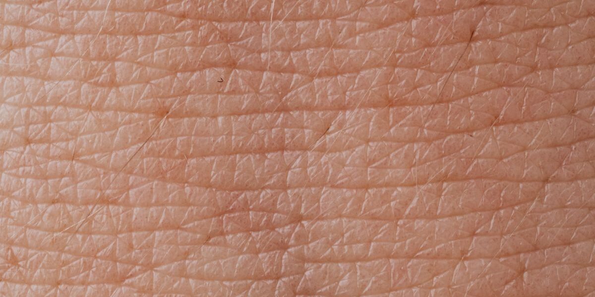 The Itch-Scratch Cycle: Why Eczema Feels Impossible to Control