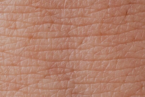 The Itch-Scratch Cycle: Why Eczema Feels Impossible to Control