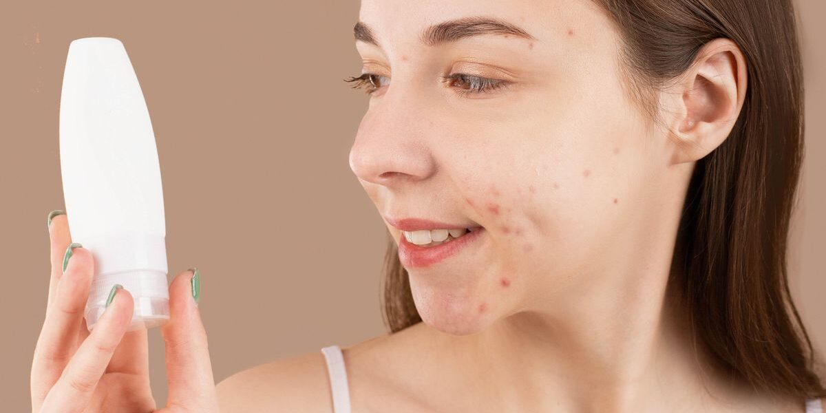 Acne Scarring: Prevention and Treatment Options