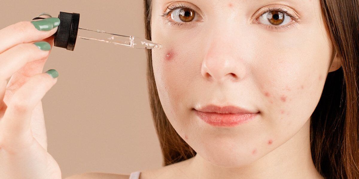 Acne Skincare: What Helps and What Makes It Worse