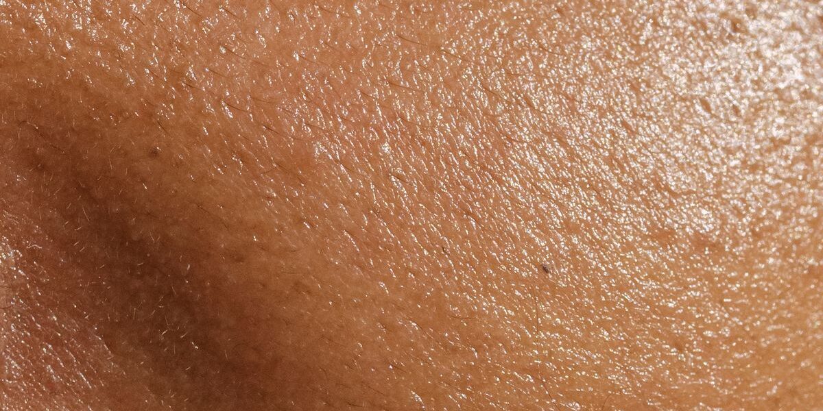 Skin Care Tips for Living in South Florida With Eczema